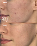 Alma Hybrid (Pixel Peel / Red Carpet Glow)