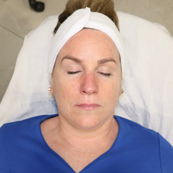 SKINS Deep Cleansing Facial   <br><b>20% OFF</b>