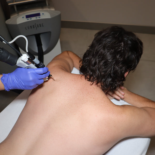 Men - Laser Hair Removal - <b> 50% OFF</b>