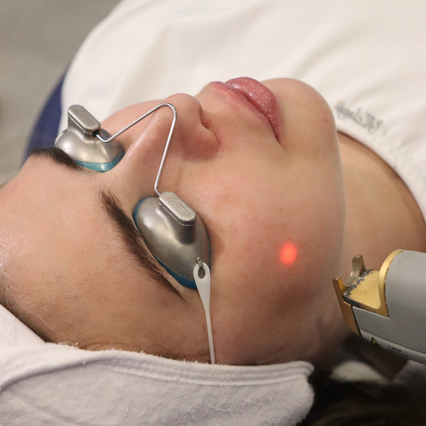 Laser Genesis Skin Rejuvenation<br><b>30% OFF</b>